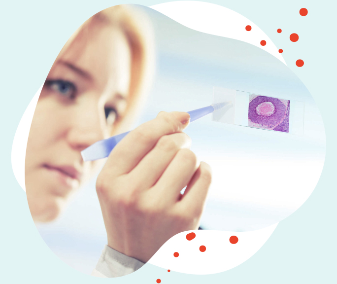 Antwort Wie lange krank nach Biopsie Brust? Weitere Antworten Kann man nach einer brustbiopsie