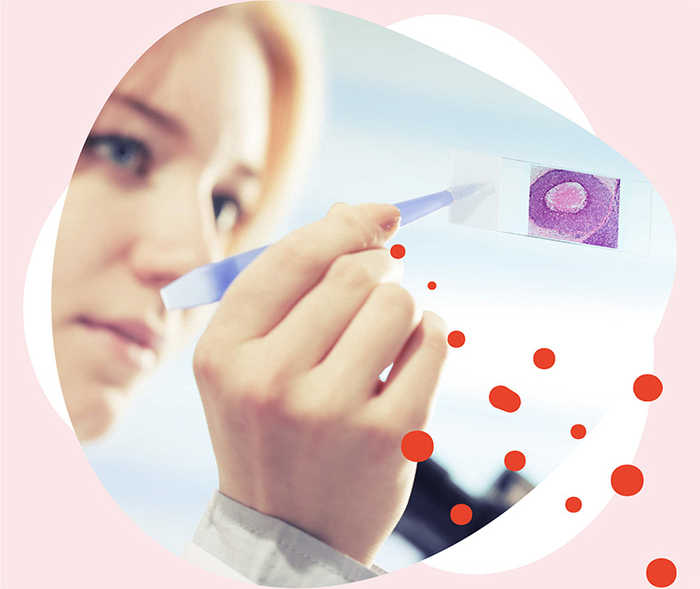 Leben mit Brustkrebs: Teaserbild zum Artikel Biopsie