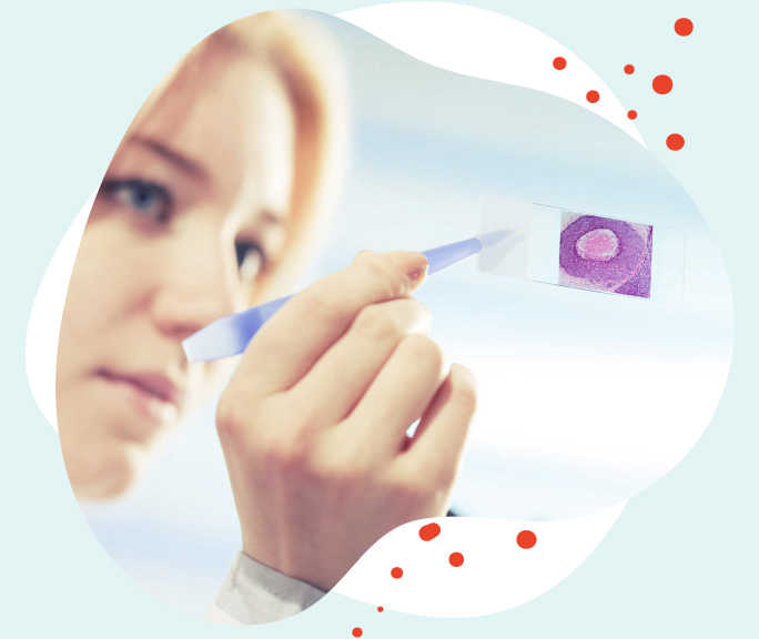 Die Biopsie Gewebeuntersuchung Leben Mit Brustkrebs