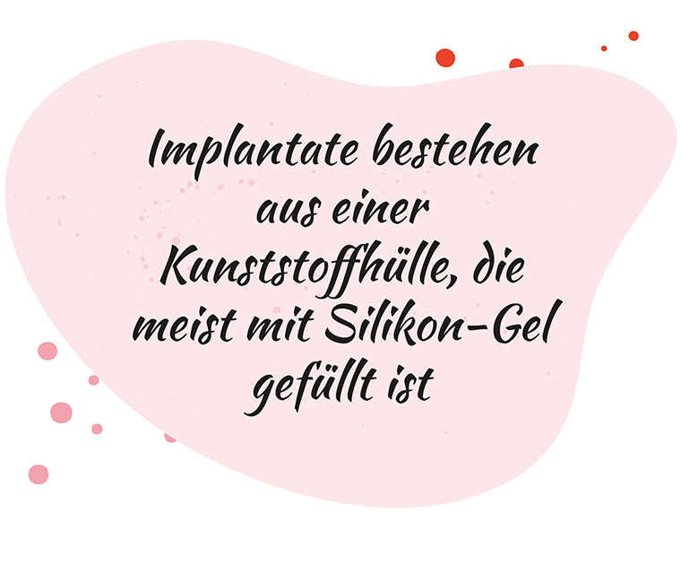 Leben mit Brustkrebs: Spruch - Implantate bestehen aus einer Kunststoffhülle, die meist mit Silikon-Gel gefüllt ist Leben mit Brustkrebs: Spruch - Implantate bestehen aus einer Kunststoffhülle, die meist mit Silikon-Gel gefüllt ist