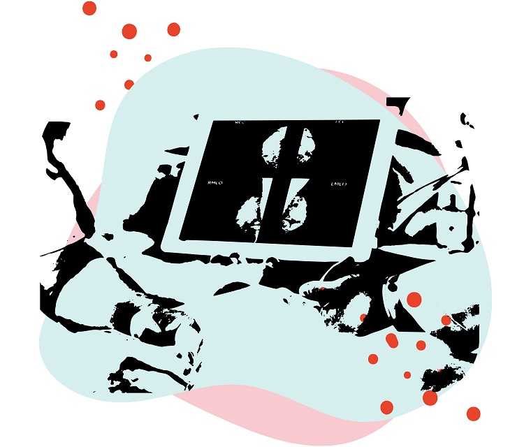 Leben mit Brustkrebs: Illustration einer Ultraschallaufnahme