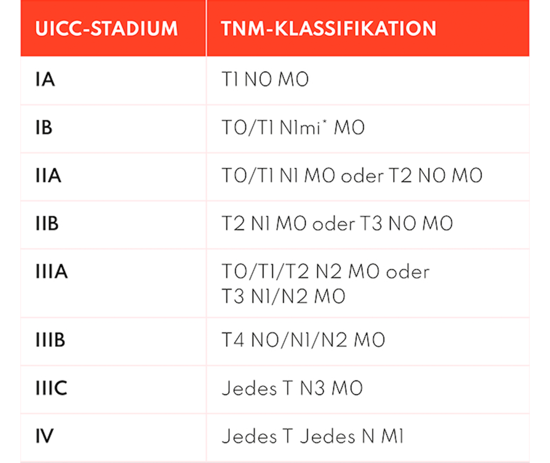 Leben mit Brustkrebs: Tabelle, die die TMN-Klassifikationen nach UICC-Stadium einteiltTNM im Detail „Ausbreitung des Tumors“